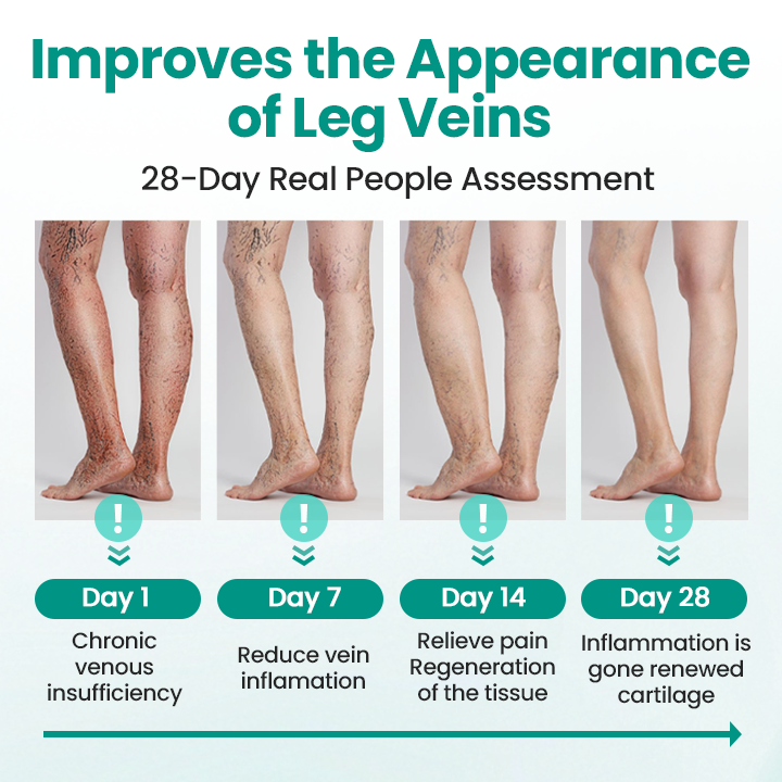Healrize® LegRenew Varicose Veins Patch✨